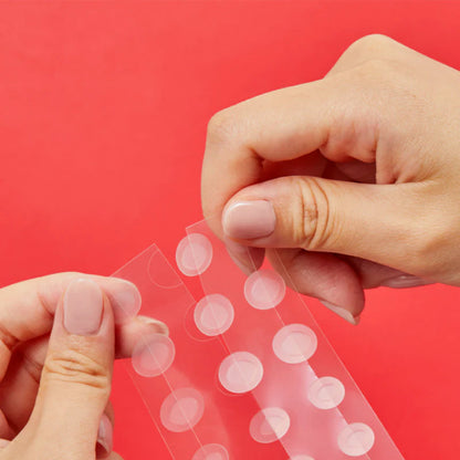 Applying COSRX hydrocolloid acne patches for fast pimple healing and spot protection on acne-prone skin