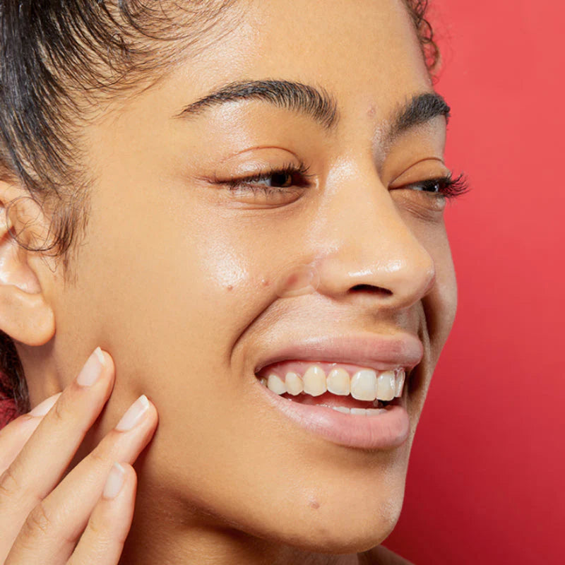Model wearing COSRX acne patch for clearer skin, reduced redness, and discreet breakout coverage