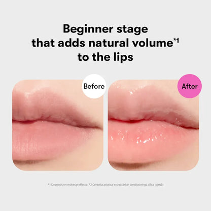 VT Cosmetics Reedle Shot Lip Plumper Beginner before after lip volume